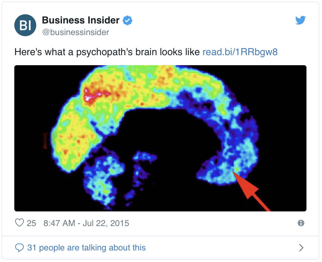 psychopathy brain scan PET