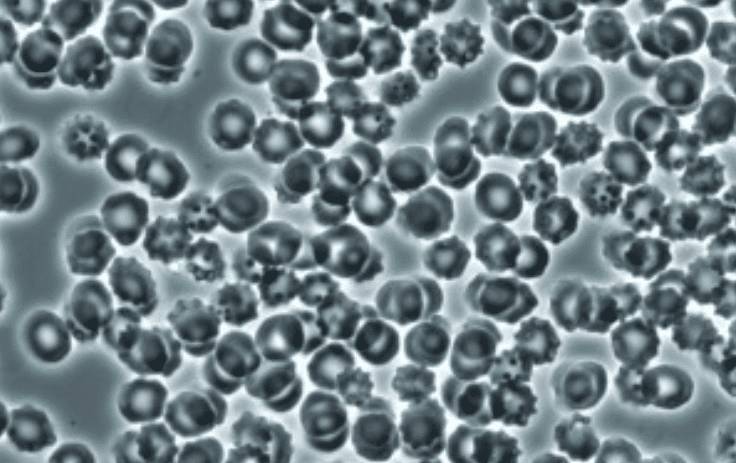 corona effect red blood cells not oxygenated
